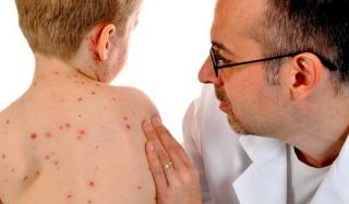 Корь в Константиновке Корь в Константиновке